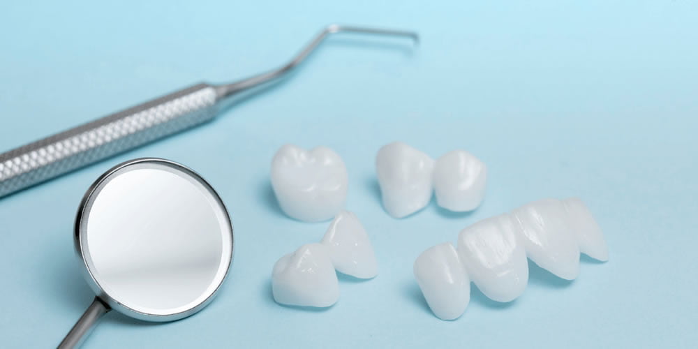 Porselen Laminalar ile Gülüş Tasarımı