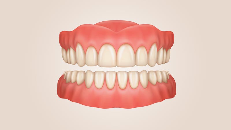diş protezleri